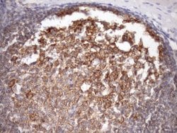 MALT1 Monoclonal Antibody (OTI4C3), TrueMAB , OriGene:Antibodies:Primary