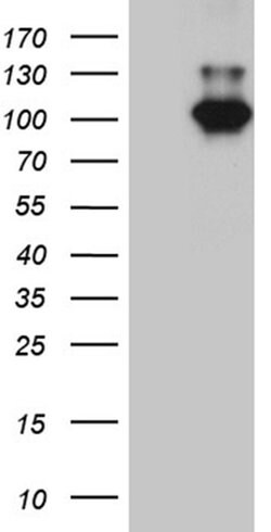 MALT1 Monoclonal Antibody (OTI1E4), TrueMAB , OriGene 100 &mu;L; Unconjugated:Antibodies,