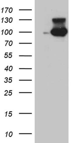 MALT1 Monoclonal Antibody (OTI6C1), TrueMAB , OriGene:Antibodies:Primary