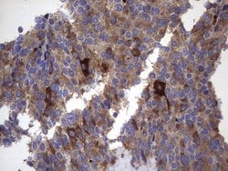 MAP1LC3A Monoclonal Antibody (OTI10H6), TrueMAB , OriGene 100 &mu;L; Unconjugated:Antibodies,