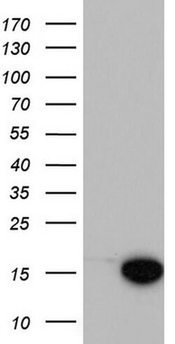 MAP1LC3A Monoclonal Antibody (OTI2D5), TrueMAB , OriGene 100 &mu;L; Unconjugated:Antibodies,
