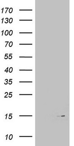 MAP1LC3A Monoclonal Antibody (OTI10H6), TrueMAB , OriGene 100 &mu;L; Unconjugated:Antibodies,