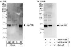 MAP1S Rabbit anti-Human, Polyclonal, Bethyl Laboratories 100 &mu;L; Unconjugated:Antibodies,