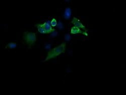 MAP2K1 Monoclonal Antibody (OTI2H3), TrueMAB , OriGene:Antibodies:Primary