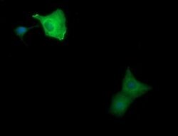 MAP2K1 Monoclonal Antibody (OTI1A9), TrueMAB , OriGene 100 &mu;L; Unconjugated:Antibodies,