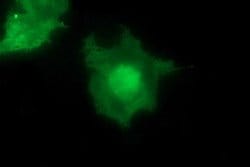 MAP2K1 Mouse anti-Human, Clone: OTI5D3, lyophilized, TrueMAB 100 &mu;g;