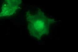 MAP2K1 Monoclonal Antibody (OTI5D3), TrueMAB , OriGene 100 &mu;L; Unconjugated:Antibodies,