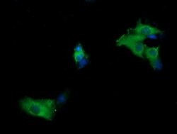 MAP2K1 Monoclonal Antibody (OTI8H1), TrueMAB , OriGene:Antibodies:Primary