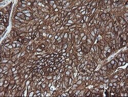 MAP2K1 Monoclonal Antibody (OTI2D4), TrueMAB , OriGene 100 &mu;L; Unconjugated:Antibodies,