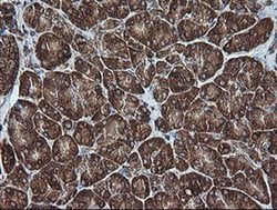 MAP2K1 Monoclonal Antibody (OTI2D4), TrueMAB , OriGene 100 &mu;L; Unconjugated:Antibodies,