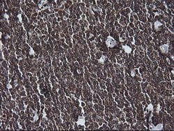 MAP2K1 Monoclonal Antibody (OTI2D4), TrueMAB , OriGene 100 &mu;L; Unconjugated:Antibodies,