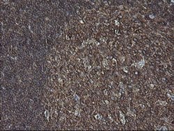 MAP2K1 Monoclonal Antibody (OTI2D4), TrueMAB , OriGene 100 &mu;L; Unconjugated:Antibodies,