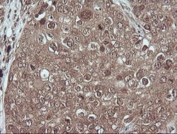 MAP2K1 Monoclonal Antibody (OTI2H3), TrueMAB , OriGene 100 &mu;L; Unconjugated:Antibodies,