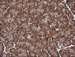 MAP2K1 Monoclonal Antibody (OTI2H3), TrueMAB , OriGene:Antibodies:Primary