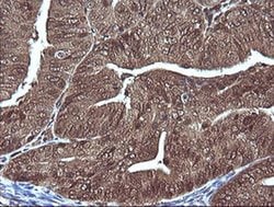 MAP2K1 Monoclonal Antibody (OTI2H3), TrueMAB , OriGene 100 &mu;L; Unconjugated:Antibodies,