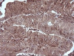 MAP2K1 Monoclonal Antibody (OTI2G5), TrueMAB , OriGene:Antibodies:Primary