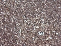 MAP2K1 Monoclonal Antibody (OTI2G5), TrueMAB , OriGene:Antibodies:Primary