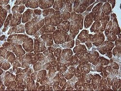 MAP2K1 Monoclonal Antibody (OTI1E5), TrueMAB , OriGene 100 &mu;L; Unconjugated:Antibodies,