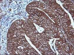 MAP2K1 Monoclonal Antibody (OTI1E5), TrueMAB , OriGene:Antibodies:Primary