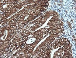MAP2K1 Monoclonal Antibody (OTI3B4), TrueMAB , OriGene 100 &mu;L; Unconjugated:Antibodies,