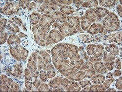 MAP2K1 Monoclonal Antibody (OTI2B7), TrueMAB , OriGene 100 &mu;L; Unconjugated:Antibodies,