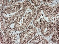 MAP2K1 Monoclonal Antibody (OTI2B7), TrueMAB , OriGene 100 &mu;L; Unconjugated:Antibodies,