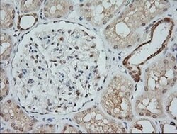 MAP2K1 Monoclonal Antibody (OTI2B7), TrueMAB , OriGene 100 &mu;L; Unconjugated:Antibodies,