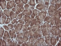MAP2K1 Monoclonal Antibody (OTI3H5), TrueMAB , OriGene:Antibodies:Primary