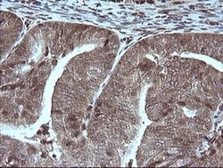 MAP2K1 Monoclonal Antibody (OTI3H5), TrueMAB , OriGene 100 &mu;L; Unconjugated:Antibodies,