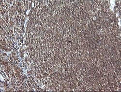 MAP2K1 Monoclonal Antibody (OTI3H5), TrueMAB , OriGene 100 &mu;L; Unconjugated:Antibodies,