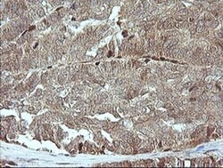 MAP2K1 Monoclonal Antibody (OTI4B1), TrueMAB , OriGene 100 &mu;L; Unconjugated:Antibodies,