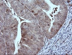 MAP2K1 Monoclonal Antibody (OTI4B1), TrueMAB , OriGene 100 &mu;L; Unconjugated:Antibodies,