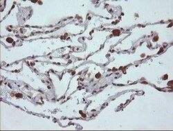 MAP2K1 Monoclonal Antibody (OTI4B1), TrueMAB , OriGene 100 &mu;L; Unconjugated:Antibodies,