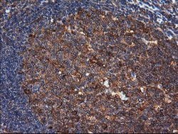 MAP2K1 Mouse anti-Canine, Human, Mouse, Rat, Clone: OTI4E1, liquid, TrueMAB