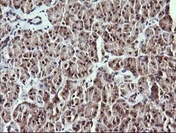 MAP2K1 Monoclonal Antibody (OTI2F1), TrueMAB , OriGene 100 &mu;L; Unconjugated:Antibodies,