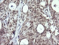 MAP2K1 Monoclonal Antibody (OTI2F1), TrueMAB , OriGene 100 &mu;L; Unconjugated:Antibodies,