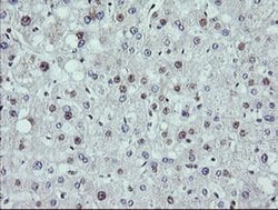 MAP2K1 Monoclonal Antibody (OTI2F1), TrueMAB , OriGene 100 &mu;L; Unconjugated:Antibodies,