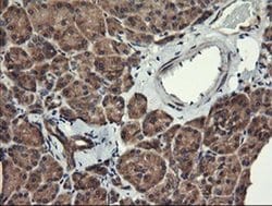 MAP2K1 Monoclonal Antibody (OTI1A9), TrueMAB , OriGene 100 &mu;L; Unconjugated:Antibodies,