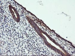MAP2K1 Monoclonal Antibody (OTI1A9), TrueMAB , OriGene 100 &mu;L; Unconjugated:Antibodies,