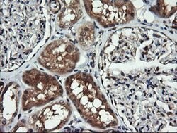 MAP2K1 Monoclonal Antibody (OTI1A9), TrueMAB , OriGene 100 &mu;L; Unconjugated:Antibodies,