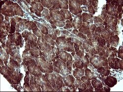 MAP2K1 Mouse anti-Human, Clone: OTI5D3, lyophilized, TrueMAB 100 &mu;g;