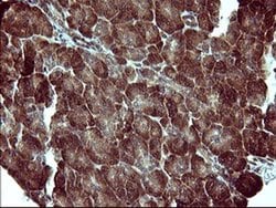 MAP2K1 Monoclonal Antibody (OTI5D3), TrueMAB , OriGene 100 &mu;L; Unconjugated:Antibodies,