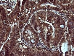 MAP2K1 Monoclonal Antibody (OTI5D3), TrueMAB , OriGene 100 &mu;L; Unconjugated:Antibodies,