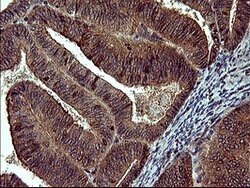 MAP2K1 Mouse anti-Human, Clone: OTI5D3, lyophilized, TrueMAB 100 &mu;g;