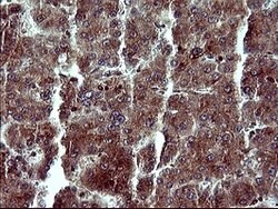 MAP2K1 Mouse anti-Human, Clone: OTI5D3, lyophilized, TrueMAB 100 &mu;g;