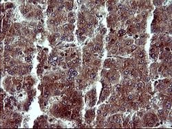 MAP2K1 Monoclonal Antibody (OTI5D3), TrueMAB , OriGene 100 &mu;L; Unconjugated:Antibodies,