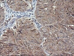 MAP2K1 Monoclonal Antibody (OTI2E8), TrueMAB , OriGene 100 &mu;L; Unconjugated:Antibodies,