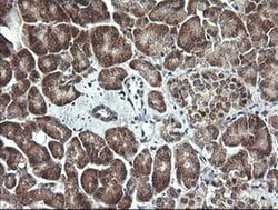 MAP2K1 Monoclonal Antibody (OTI2E8), TrueMAB , OriGene 100 &mu;L; Unconjugated:Antibodies,
