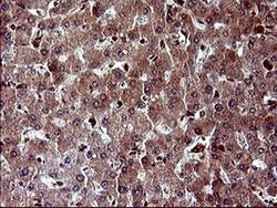MAP2K1 Monoclonal Antibody (OTI9E9), TrueMAB , OriGene:Antibodies:Primary