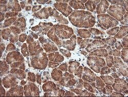 MAP2K1 Monoclonal Antibody (OTI8A6), TrueMAB , OriGene 100 &mu;L; Unconjugated:Antibodies,